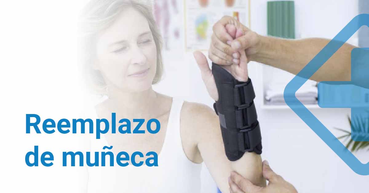 Reemplazo de muñeca